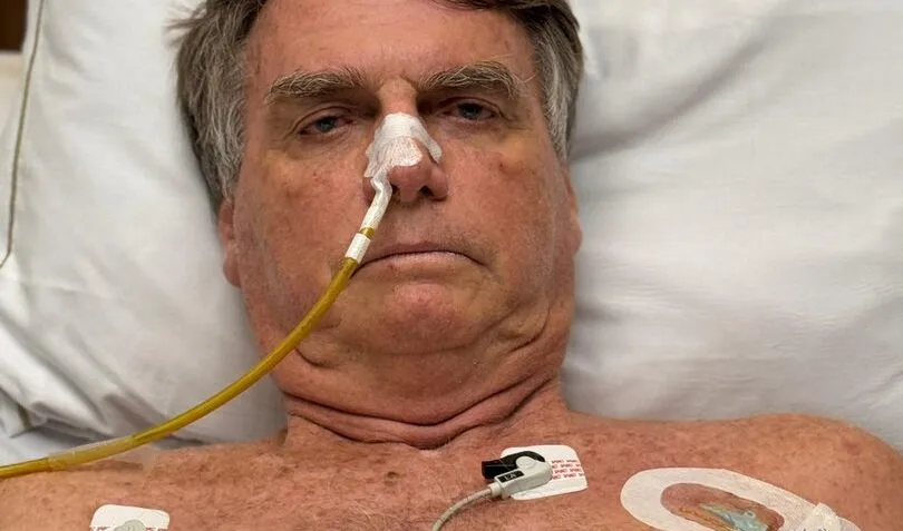 jair bolsonaro internado 18abr2025 810x477 1